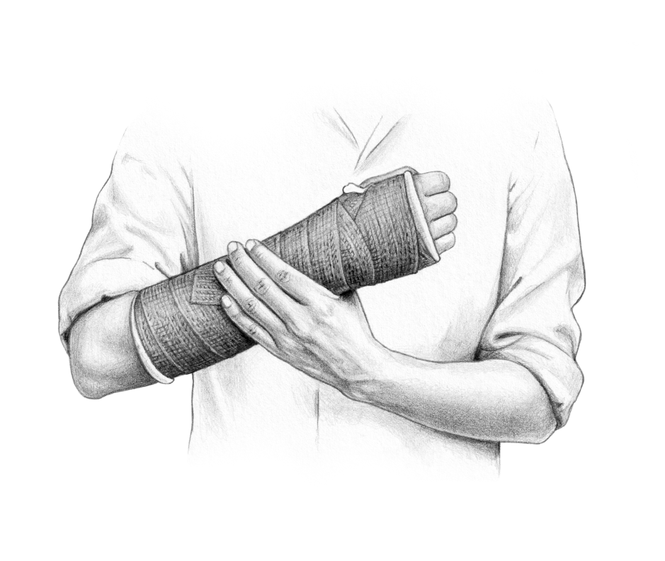 Person with arm in cast